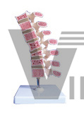 The model of spondyle pathology